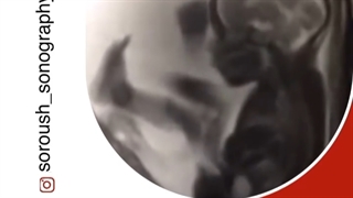 جنین خوشحال در رحم مادر