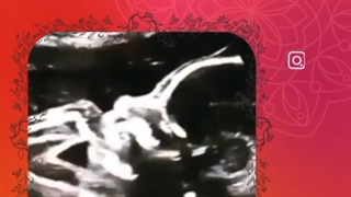 جنین در حال مکیدن انگشت در شکم مادر