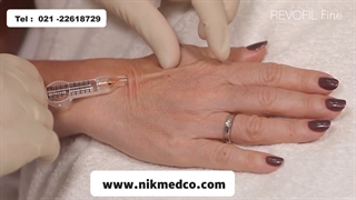 ژل روفیل فاین بر روی دست