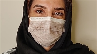 بلفاروپلاستی پلک بالا