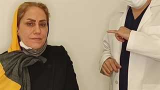 بلفاروپلاستی پلک بالا و پلک پایین