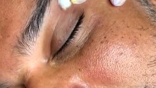 برداشت خال 1 2 3
