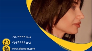 بینی نیمه فانتزی