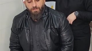 بعد از کاشت مو کلینیک آرتان