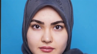 جراحی بینی بعد از گذشت 6 ماه