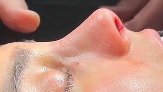 اتاق عمل جراحی بینی