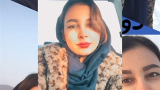 دوماه بعد از جــراحی بینی