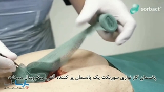 پانسمان گاز نواری سوربکت