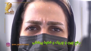 تزریق بوتاکس