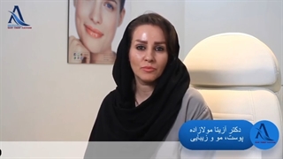 رضایت زیباجوی عزیز از تزریق بوتاکس