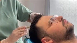 تزریق مزوی مو