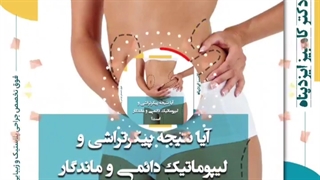 نتیجه لیپوماتیک و پیکرتراشی