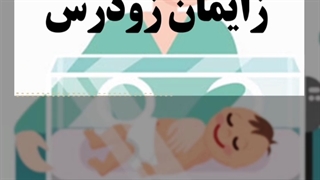 زایمان زودرس