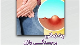.چه زمانی برجستگی واژن خطرناک است؟