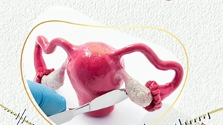 انواع کیست تخمدان