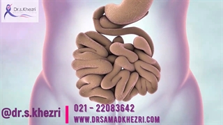 سرطان روده چیست | سرطان روده چگونه بوجود می آید