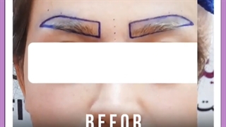 بارداری و کاشت ابرو