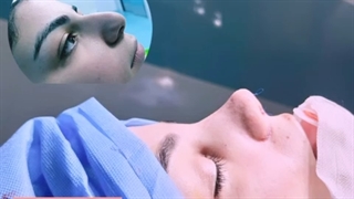 دکتر اسماعیل عارف زاده جراح زیبایی بینی متخصص گوش حلق بینی . قسمت یک از سه . عمل زیبایی