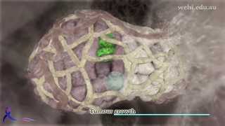 رشد سلول های سرطانی در پستان