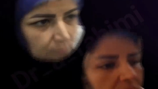 جراحی زیبایی پلک