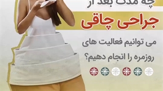 ,چه مدت بعد از جراحی چاقی می توانیم فعالیت های روزمره را انجام دهیم؟