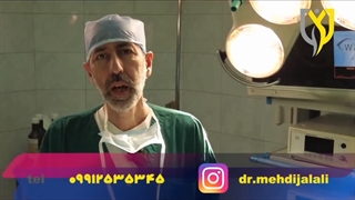 تفاوت اسلیو و بای پس