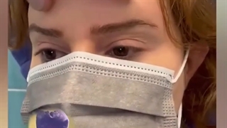 یک ماه بعد از عمل جراحی لیفت ابرو اندوسکوپیک