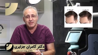 چه سنی برای انجام پیوند مو مناسبه؟