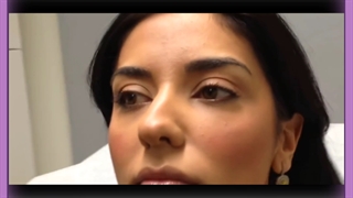 تزریق فیلر رفع غبغب