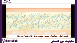 تزریق فیلر تزریق بوتاکس