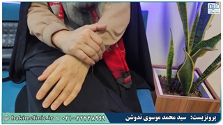 پروتز سیلیکونی دست - کلینیک ارتوپدی فنی حکیم