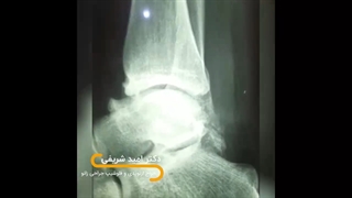 مرگ تالوس 02