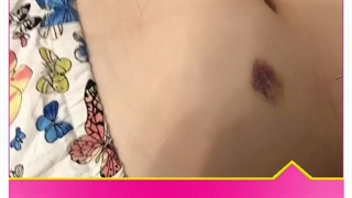 درمان تمام مشکلات با طب سوزنی