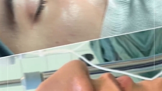 جراحی بینی  | دکتر علی الستی