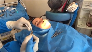 در مطب ما 72 ساعت بعد روکش ایمپلنت را تحویل بگیرید