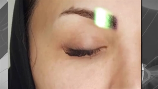 کاشت ابرو کاملا طبیعی
