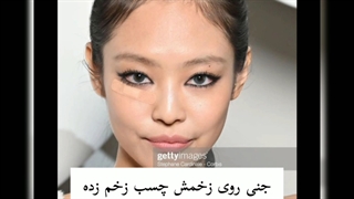 جنی روی زخم چشمش، چسب زخم زده و حالا....