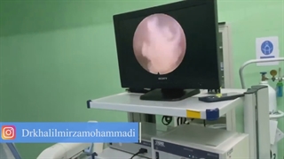 جراحی آندوسکوپیک دیسک کمر