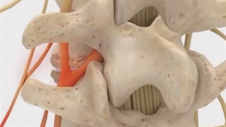 آیا خوردن لبنیات موجب درد مفاصل می شود؟