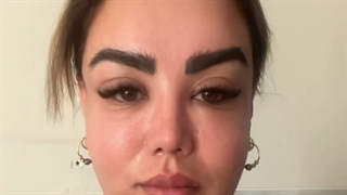 دو ماه بعد از عمل