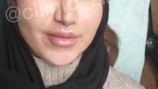 لیفت لب سانترال لب