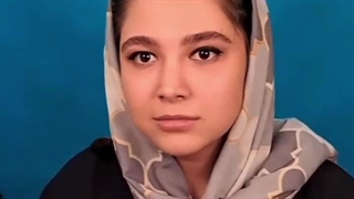 نمونه جراحی بینی بعد از دو سال | دکتر علی منافی