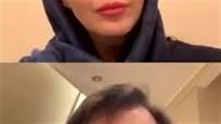 اندوسکوپیک_ابرو