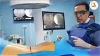 درمان دیسک کمر شدید با دیسکوژل