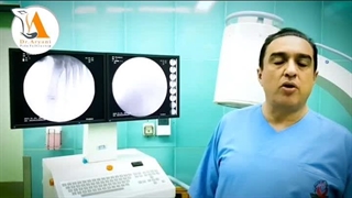 پیشگیری زانو