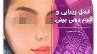 . رضایت مراجعه کننده عزیمون از جراحی