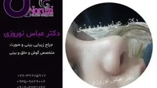 جراحی بینی زیباجوی عزیزمون