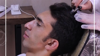 مزوتراپی موی سر  یکی از خدمات مرکز زیبایی شادمهر بوده که برای رفع ریزش مو. تقویت مو. تقویت برای موهای ضعیف بعد کاشت