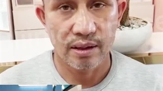 بلافاصله بعد از لیفت صورت