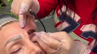 ریموو تاتو بدون لیزر با روش های تضمینی توسط نیلوفر کاظمی